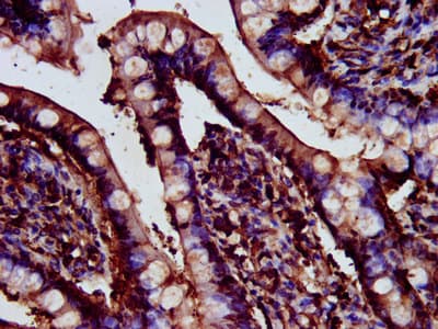 CDR2L Antibody