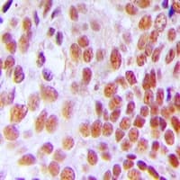 Polyclonal Rabbit anti-Human GTF3C2 Antibody (N-Terminus, IHC, WB)