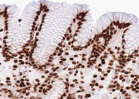 Polyclonal Rabbit anti-Human TP53 / p53 Antibody (IHC, IF, WB)