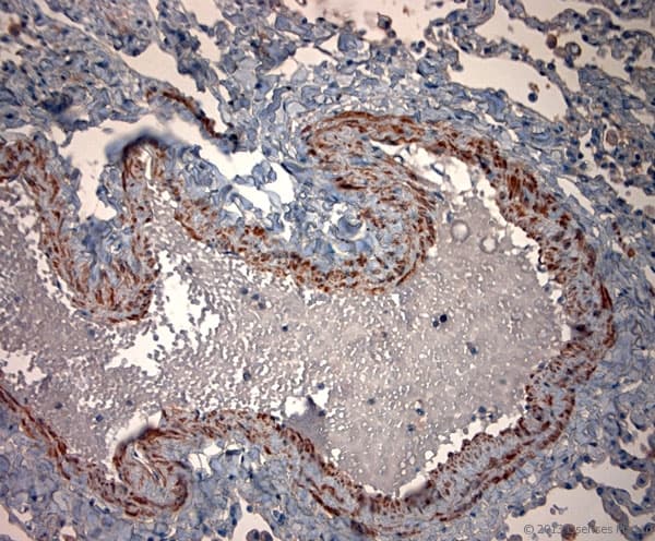 TPC2 / TPCN2 Antibody (aa700-752)