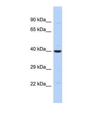 ZNF551 Antibody (aa31-80)