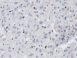 MSI1 / Musashi 1 Antibody (clone OTI3G4)