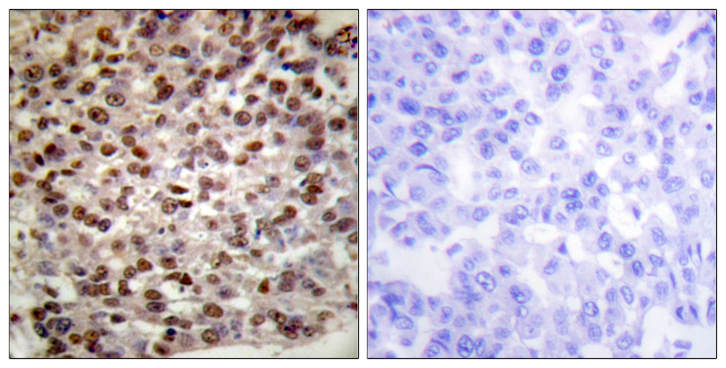 Polyclonal Rabbit anti-Human Histone H2B Antibody (Acetyl-Lys15, IHC, IF, WB)