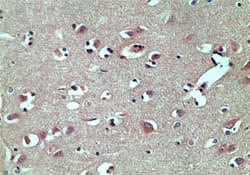 TARBP2 / TRBP2 Antibody (aa340-390)