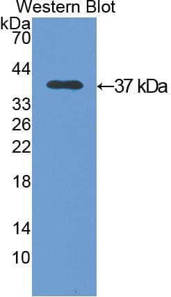 Polyclonal Rabbit anti-Rat ANXA5 / Annexin V Antibody (Biotin, aa1-319, WB)