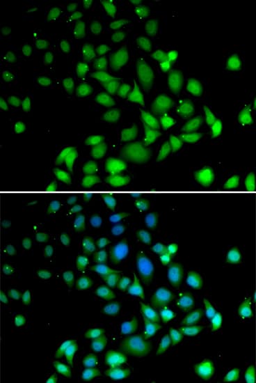 Polyclonal Rabbit anti-Human PARN Antibody (IHC, IF, WB)