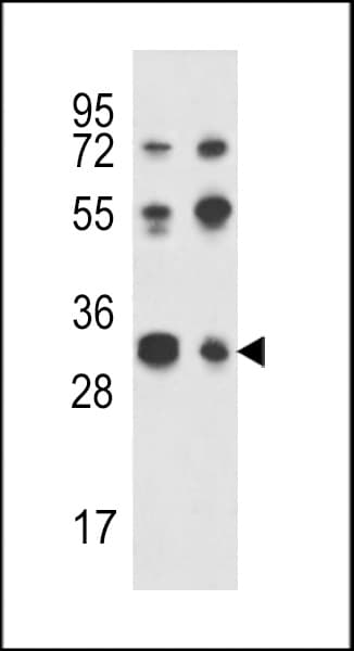 Polyclonal Rabbit anti-Human TWISTNB Antibody (aa298-326, IHC, WB)
