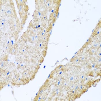 Polyclonal Rabbit anti-Human COXG / COX6B1 Antibody (IHC, WB)