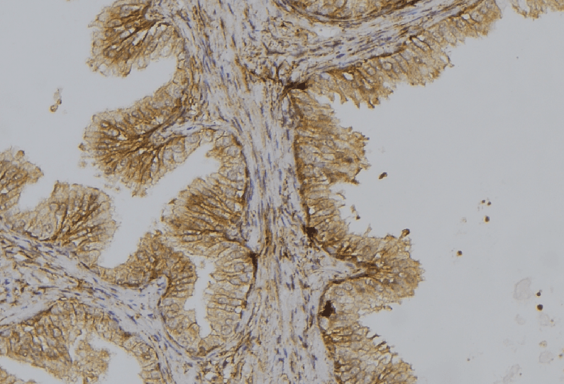 CTPS Antibody