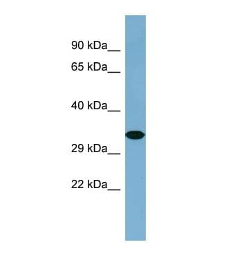 Polyclonal Rabbit anti-Human KNG1 / Kininogen / Bradykinin Antibody (C-Terminus, WB)