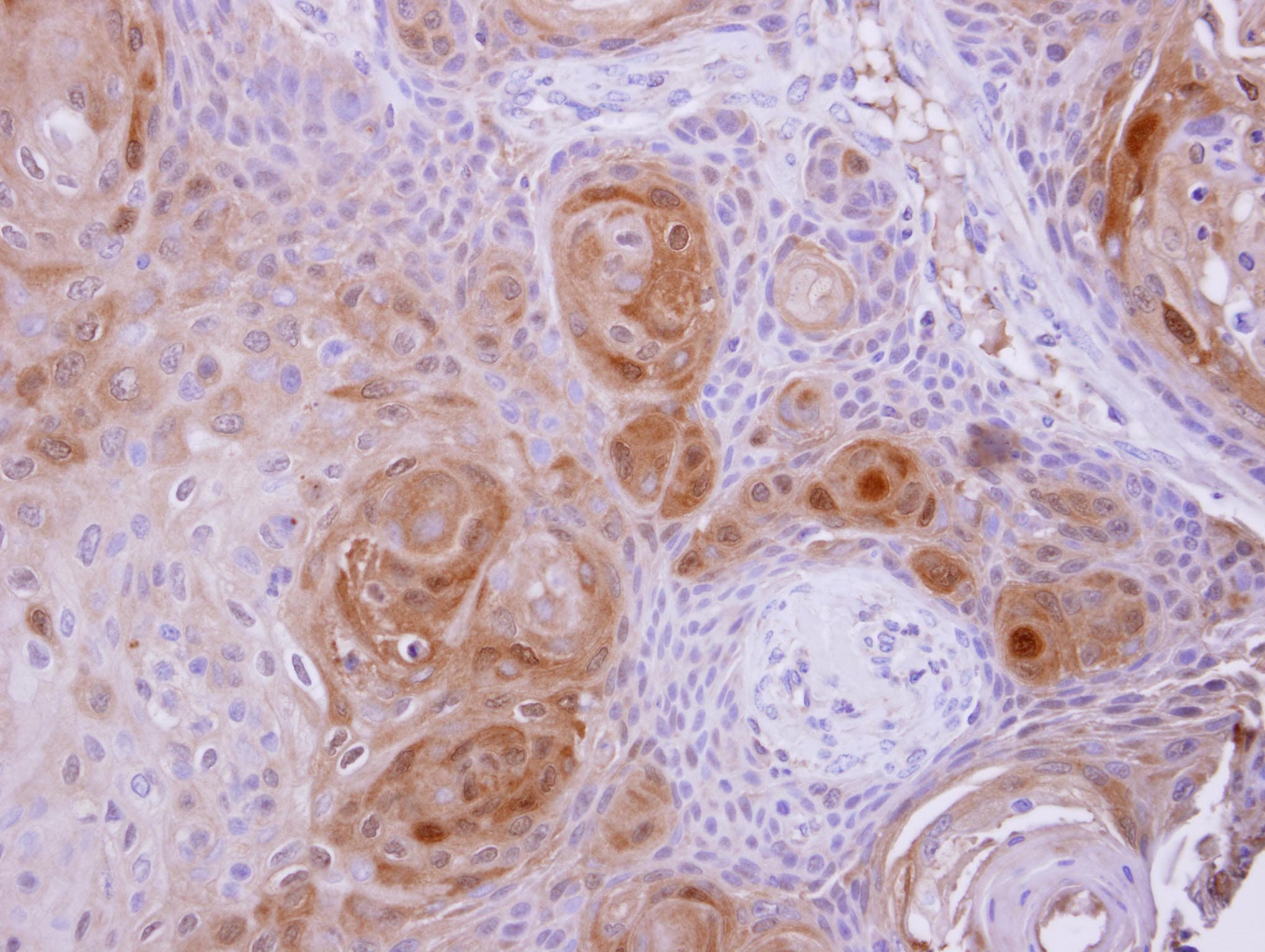 Polyclonal Rabbit anti-Human BBOX1 / BBOX Antibody (aa1-293, IHC, WB)