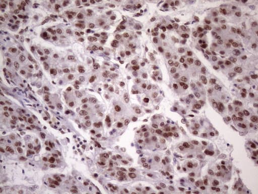NUDT21 Antibody (aa2-227, clone OTI13H1)