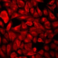 Polyclonal Rabbit anti-Human POLR2J Antibody (IF, WB)