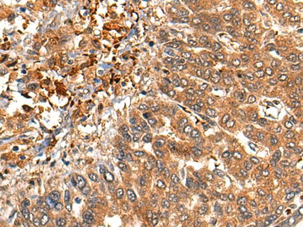Polyclonal Rabbit anti-Human C-TAK1 / MARK3 Antibody (IHC)