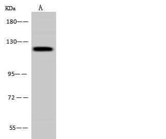 PITRM1 / MP1 Antibody