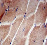 Polyclonal Rabbit anti-Human RPL5 / Ribosomal Protein L5 Antibody (aa1-30, IHC, WB)