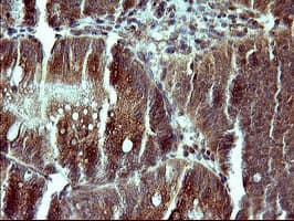 Placental Lactogen Antibody (clone OTI1C9, Carrier-free)