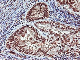 Monoclonal Mouse anti-Human SAMHD1 Antibody (clone OTI2A5, IHC, IF, WB)