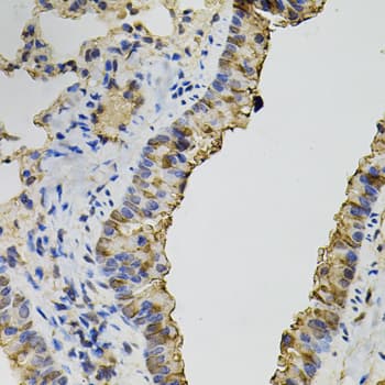 DNM2 / Dynamin-2 Antibody