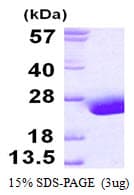 Human FABP9 / Lipid-Binding Protein (Recombinant His)