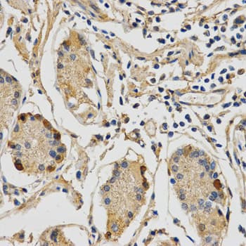 Polyclonal Rabbit anti-Human STXBP1 / MUNC18-1 Antibody (IHC, WB)