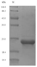 Human AGTR2 / AT2 Receptor Protein (Recombinant 6His-SUMO, N-terminus)