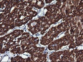 Monoclonal Mouse anti-Human ACAA2 Antibody (clone OTI2F6, IHC, IF, WB)
