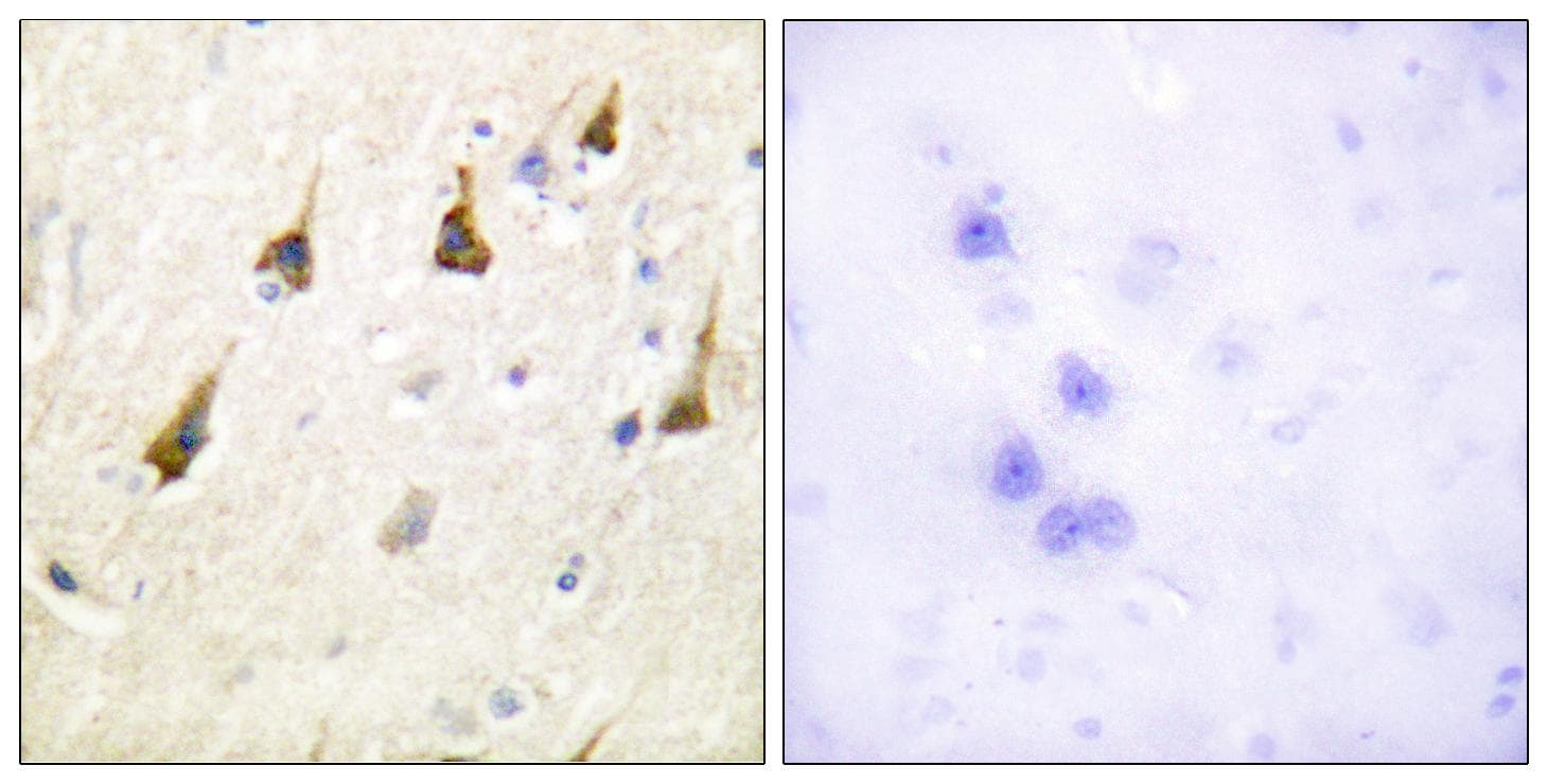 SENP7 Antibody