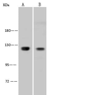 Polyclonal Rabbit anti-Human NFKB1 / NF-Kappa-B Antibody (IF, WB)