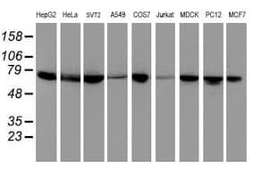 DTNB / Dystrobrevin Beta Antibody (clone OTI2E4)
