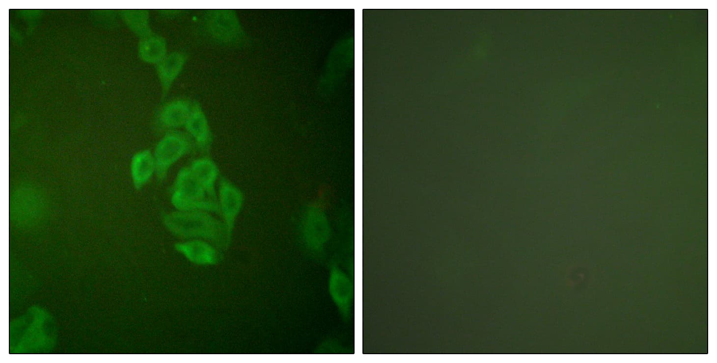 IHC-plus™ ENO2 / NSE Antibody (aa371-420)