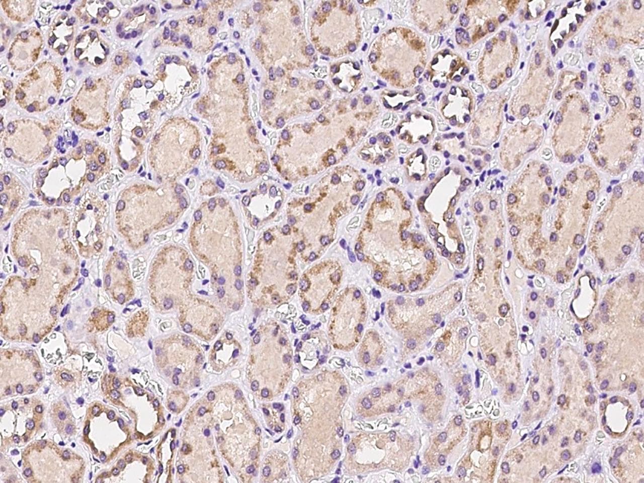 SLC31A2 Antibody