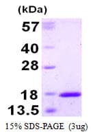Human TXNL4A Protein (Recombinant His)