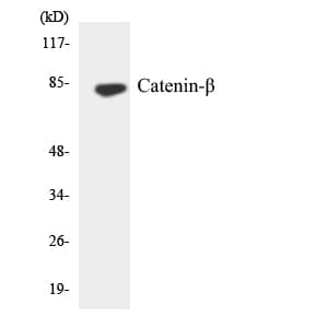 CTNNB1 / Beta Catenin Antibody (aa433-482)