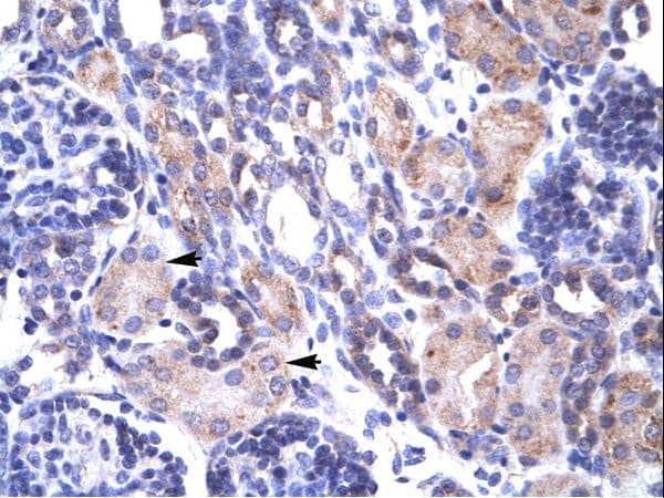 TRAP1 / HSP75 Antibody (aa41-90)
