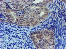 LHX1 Antibody (aa100-362, clone OTI2D5)