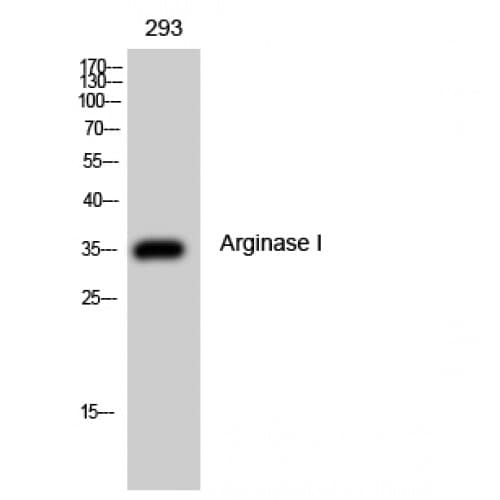 Polyclonal Rabbit anti-Human ARG1 / Arginase 1 Antibody (30-110 aa, Internal, WB)