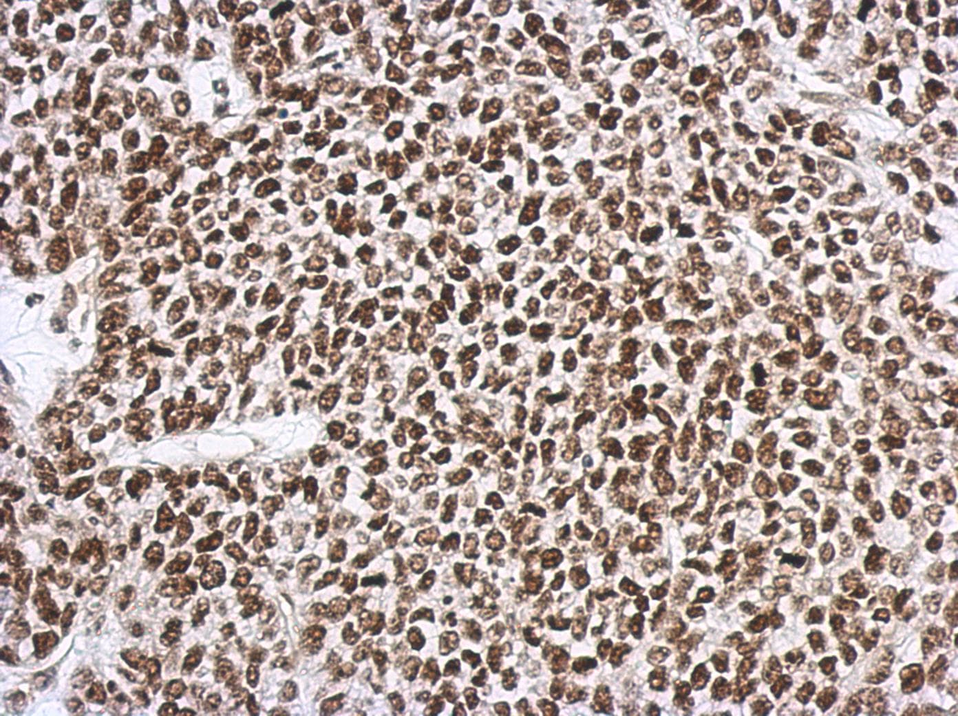Polyclonal Rabbit anti-Human SNIP1 Antibody (IHC, WB)