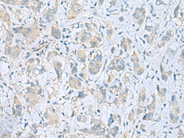 PLN / Phospholamban Antibody