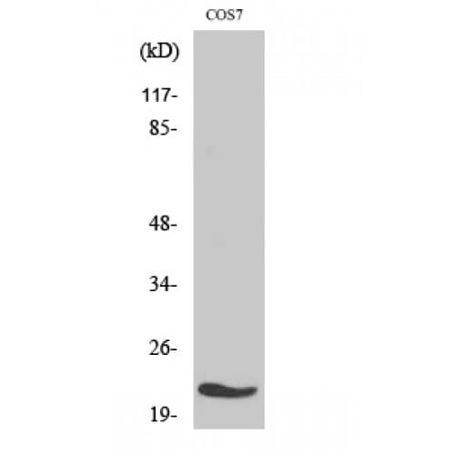 Polyclonal Rabbit anti-Human MRPL11 Antibody (40-120 aa, Internal, IHC, IF, WB)