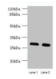 TMEM38B Antibody