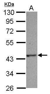 Polyclonal Rabbit anti-Human HAUS4 Antibody (IHC, WB)