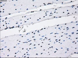 RNF144B Antibody (clone OTI9H10)