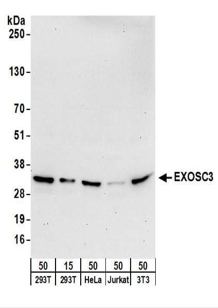 EXOSC3 Antibody (aa225-275)