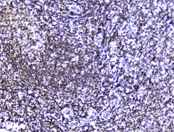 HMGN2 Antibody