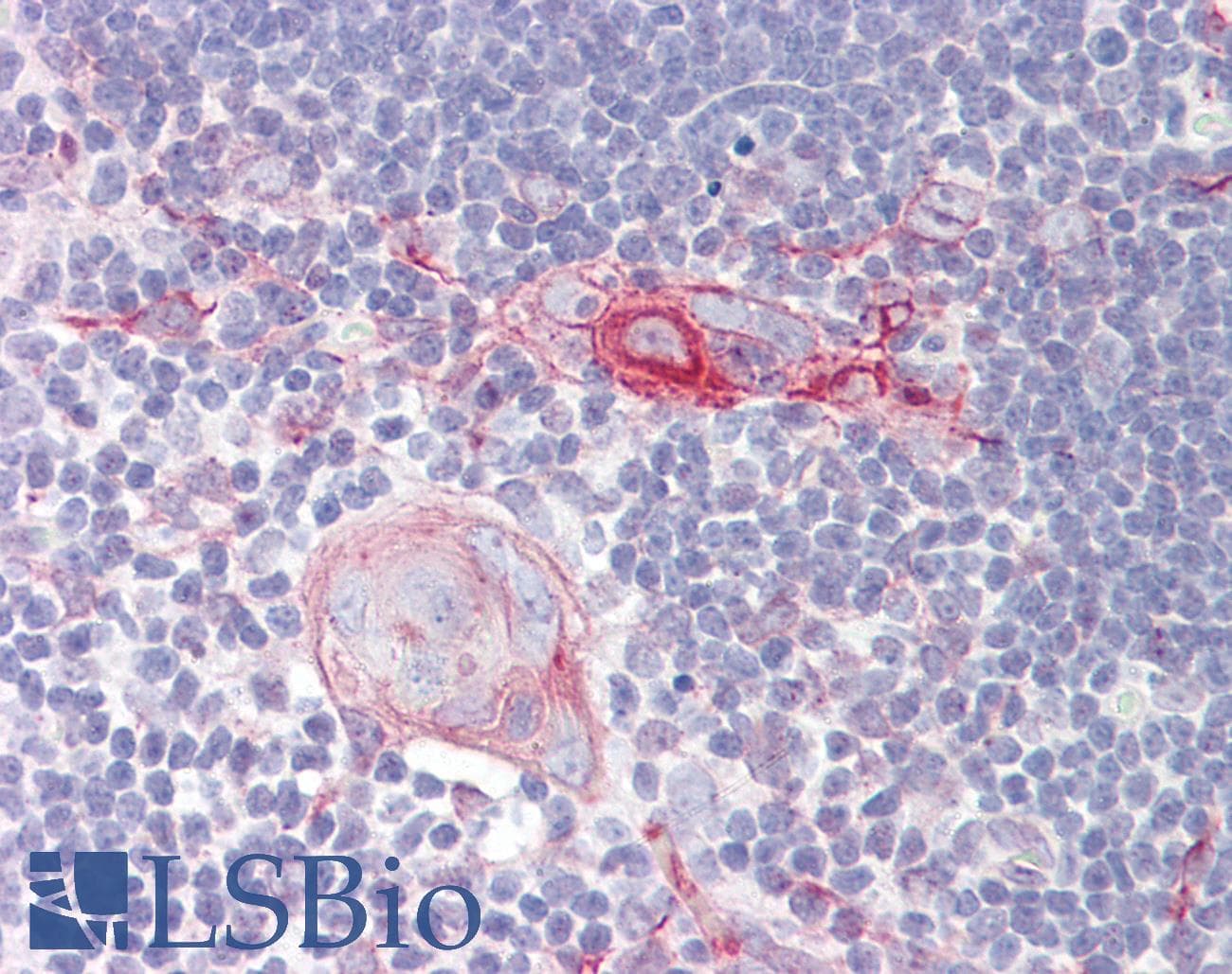 CRF2-12 / IL28RA Antibody (aa51-100)