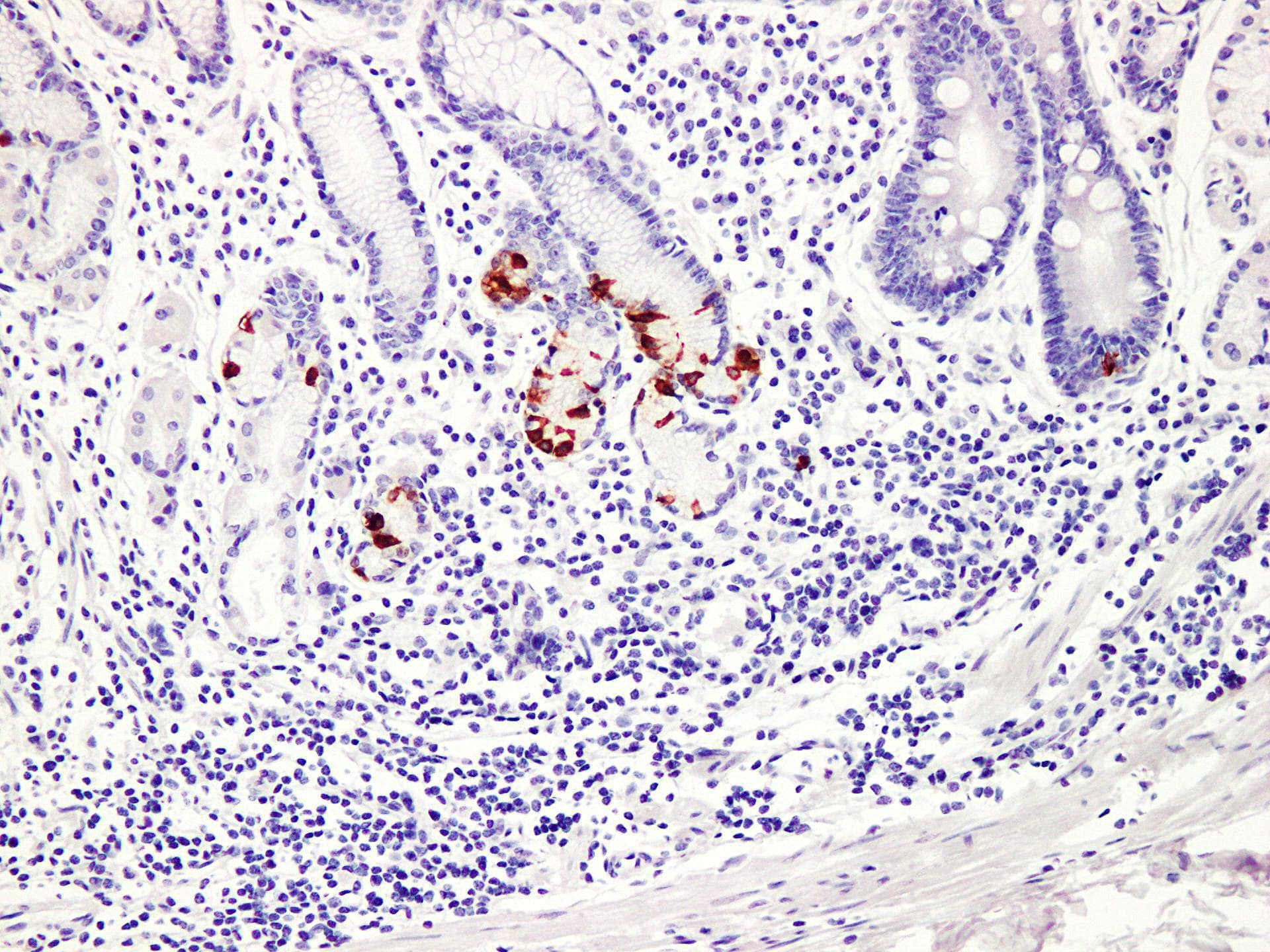 Gastrin Antibody