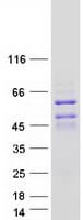 Human DACH2 Protein (Recombinant Myc-DDK (Flag))