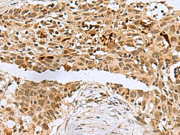 BCL7B Antibody