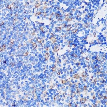 Polyclonal Rabbit anti-Human MPO / Myeloperoxidase Antibody (IHC)